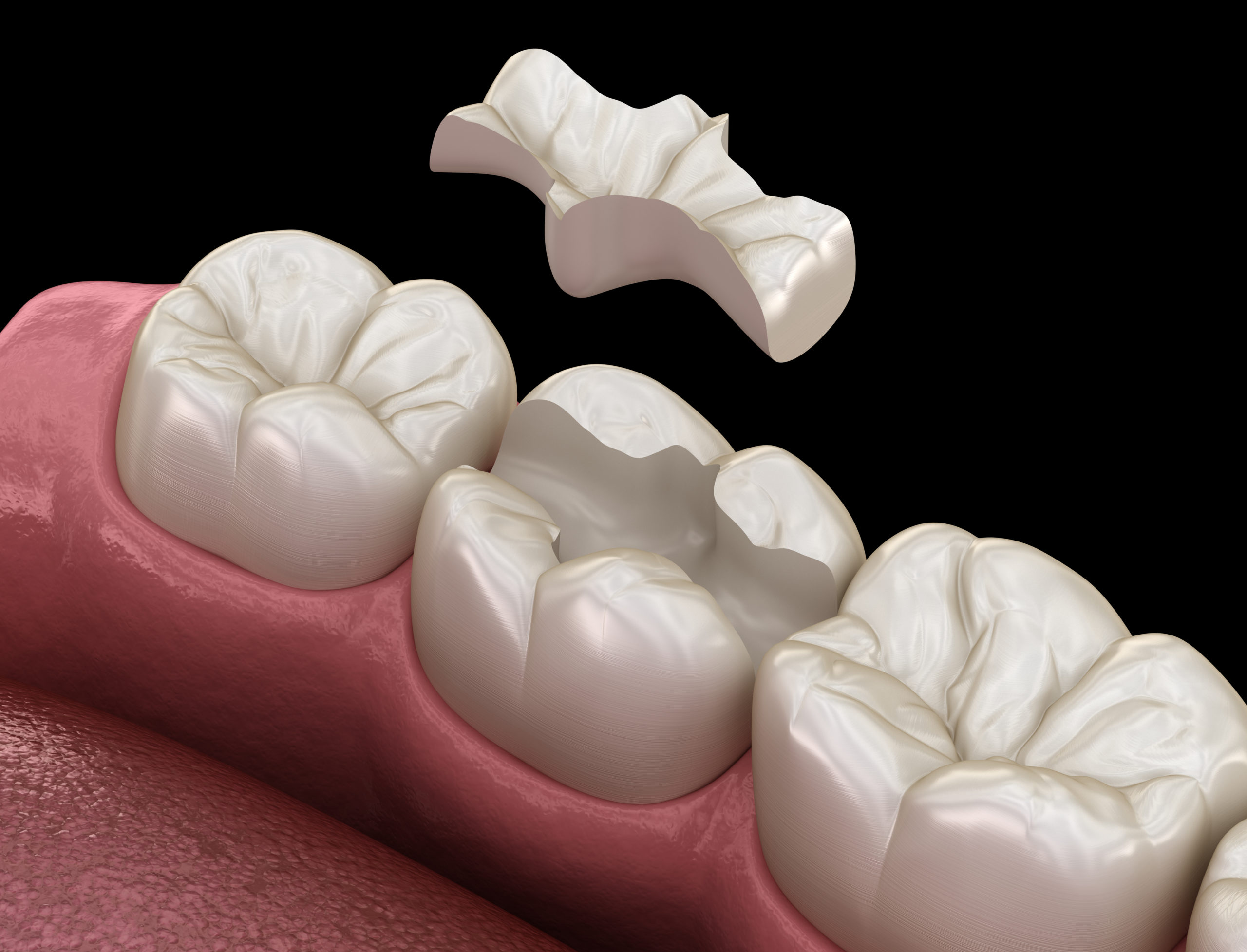 http://centredentairemassira.com/wp-content/uploads/2024/02/shutterstock_1797489829-scaled-1.jpg